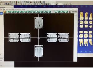 X-Rays